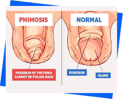 Dr. Avinash Singh Urologist Agra