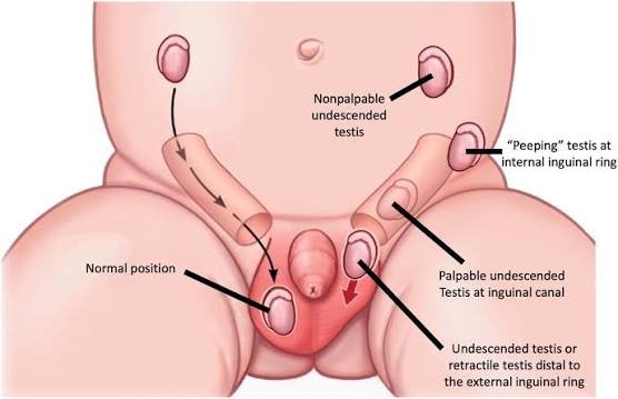 Dr. Avinash Singh Pediatric Urologist Agra