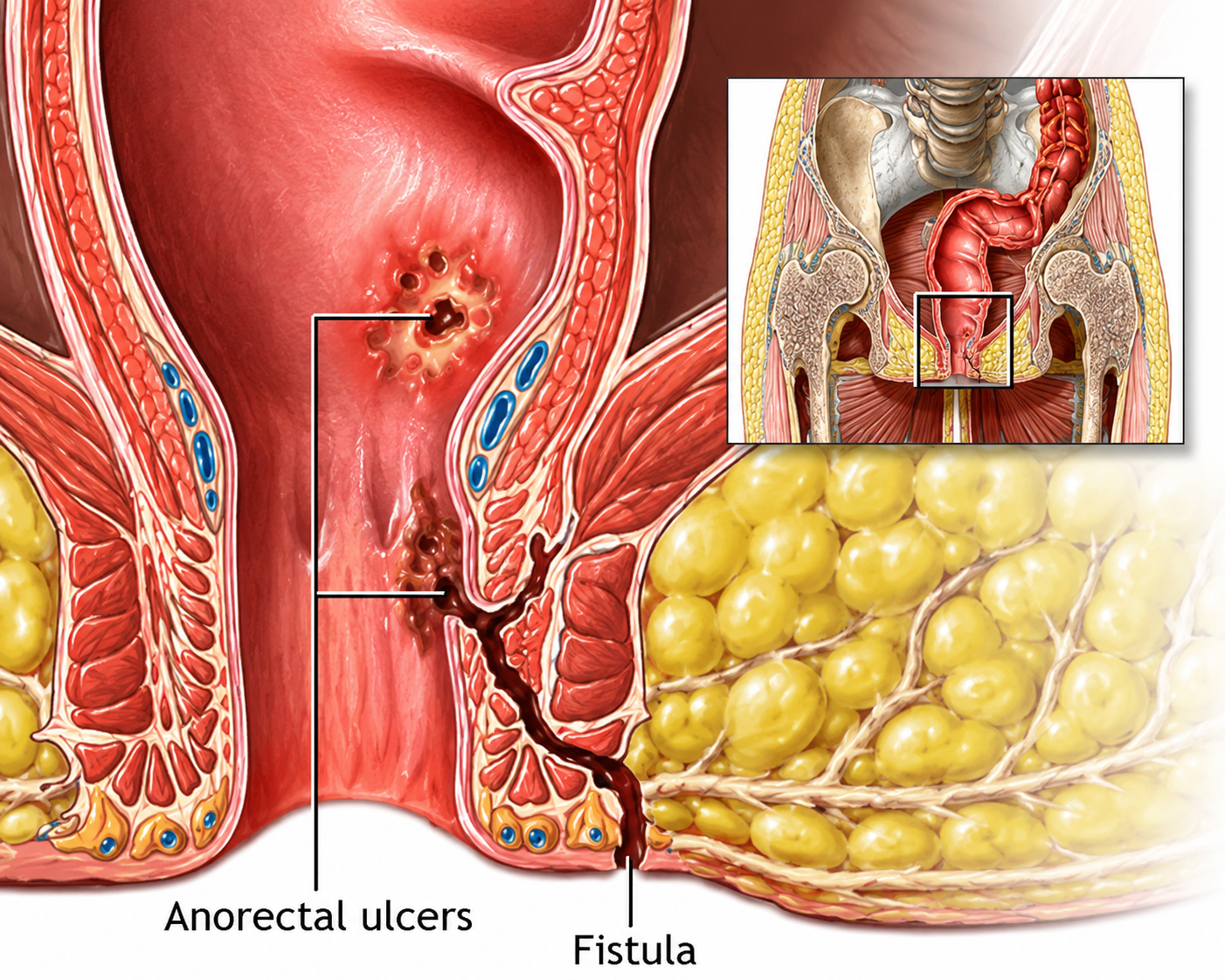 Dr. Avinash Singh Reconstructive Urologist Agra